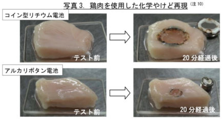 化学やけど